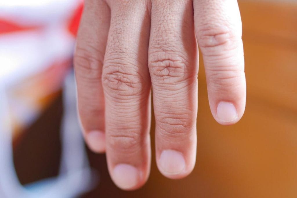 ongle blanc maladie du foie​