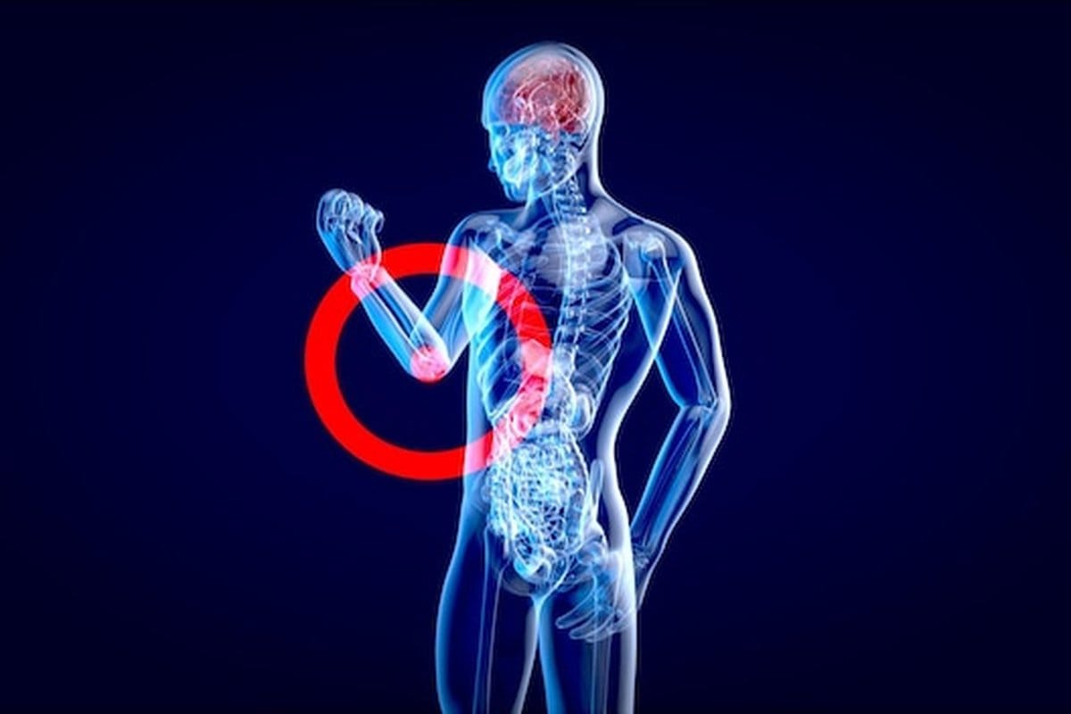 cancer des os phase terminale symptomes