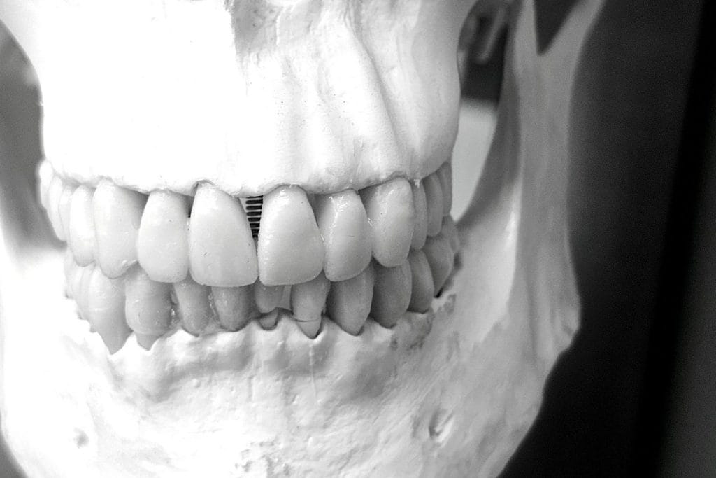 opération maxillo facial raté