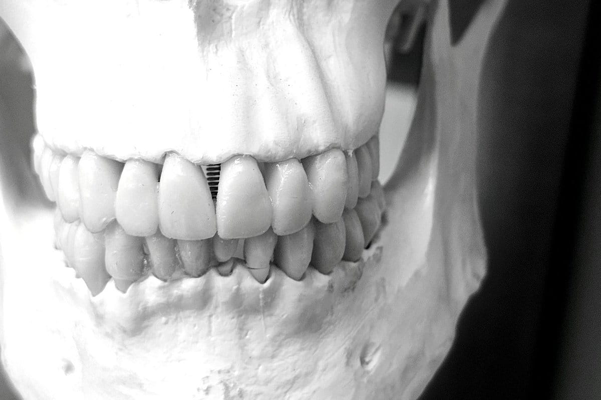 opération maxillo facial raté