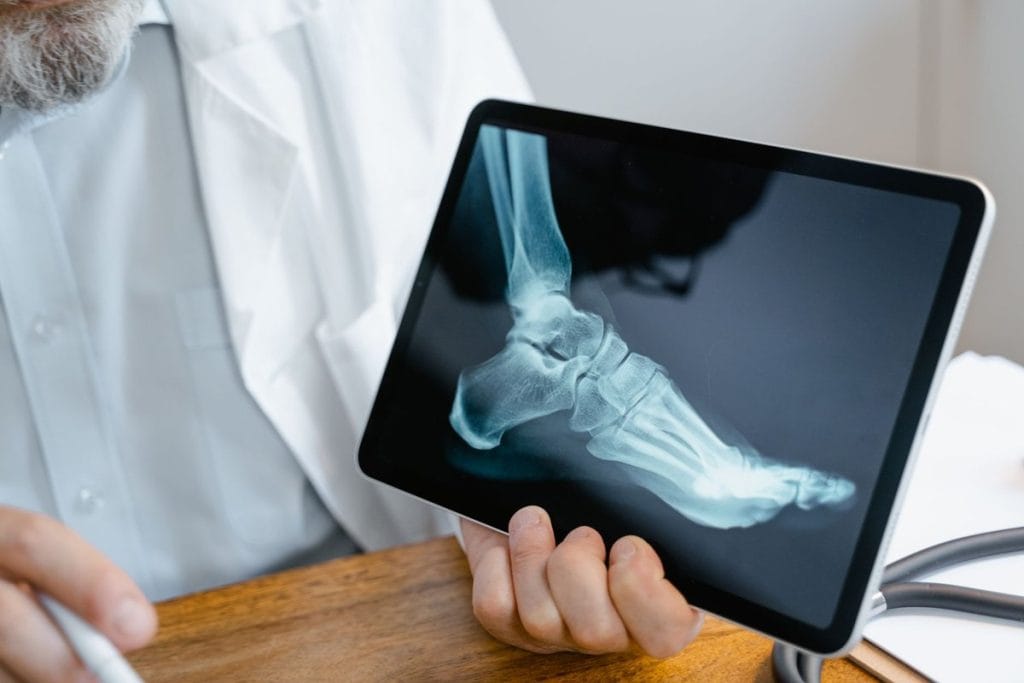semelles orthopédiques effets secondaires