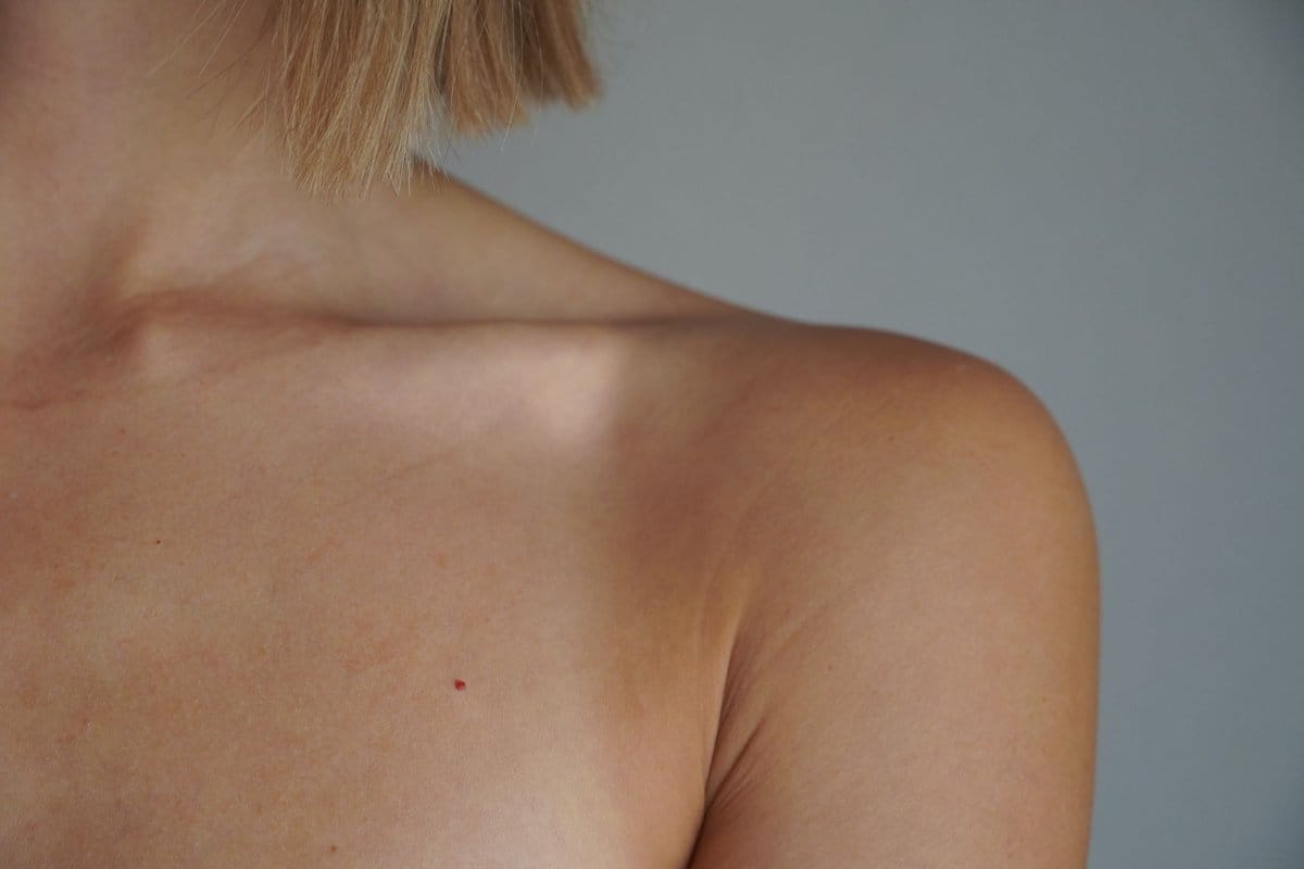 clavicule courte